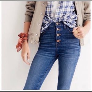 Madewell Button-Fly High-Rise Skinny Jeans